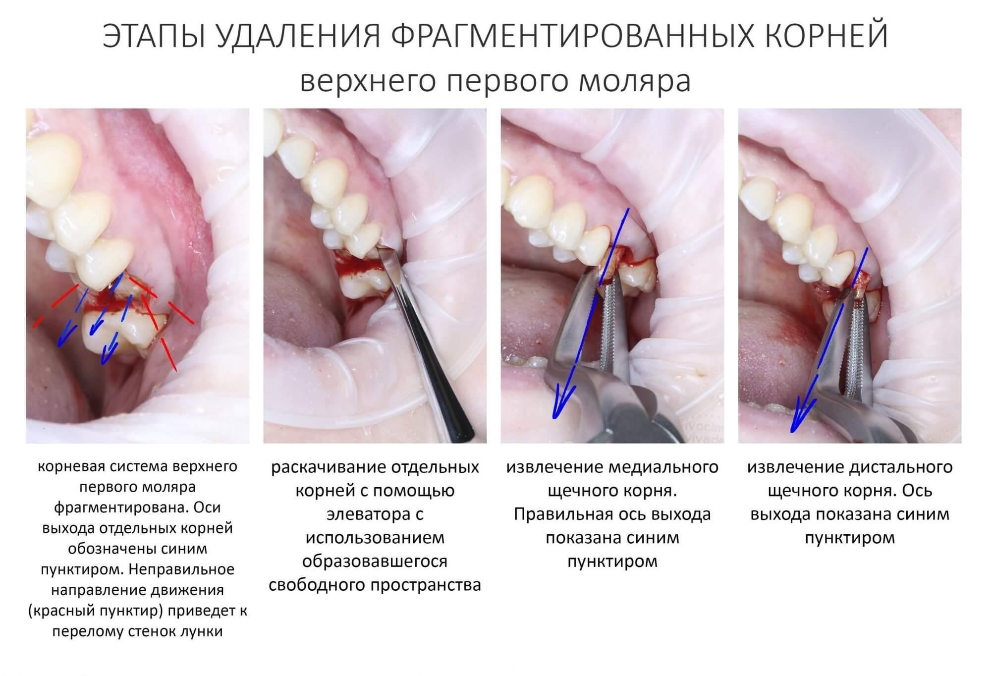 Шаги, которые необходимо предпринять, прежде чем обращаться к врачу за удаленной консультацией