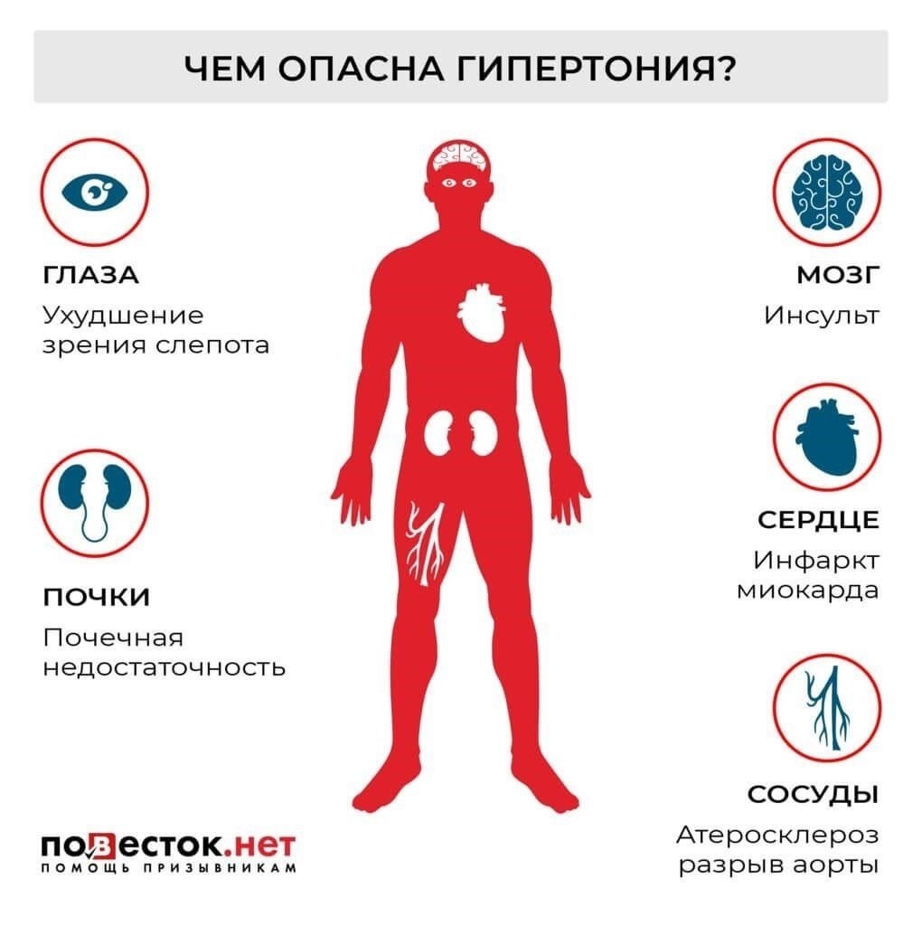 Как гипертония влияет на пригодность к военной службе