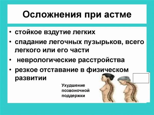 Что посоветуете жителям для предупреждения астмы?
